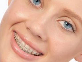 Ballarat Braces