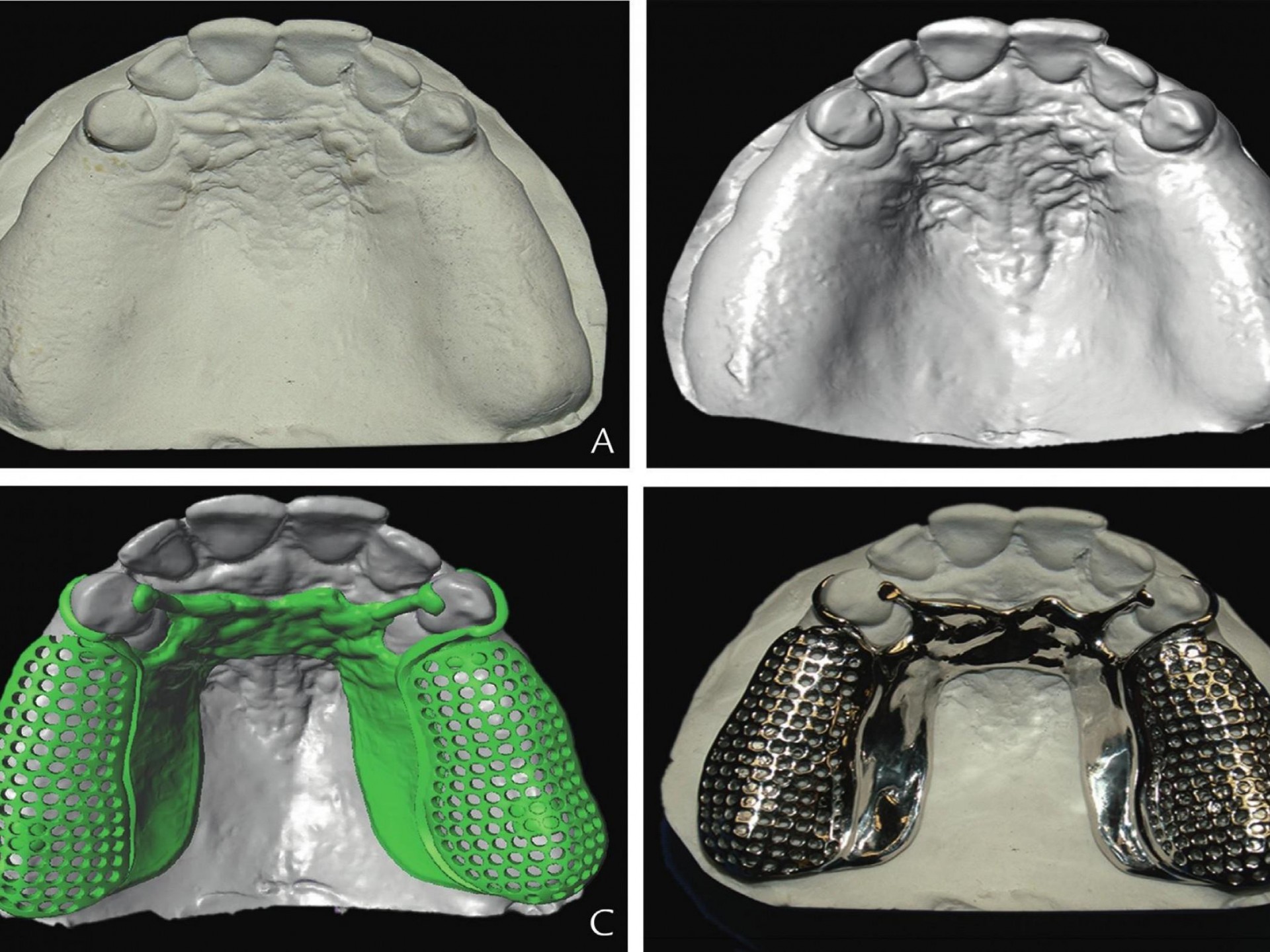 Dentures & Dental Ceramic 531950 2