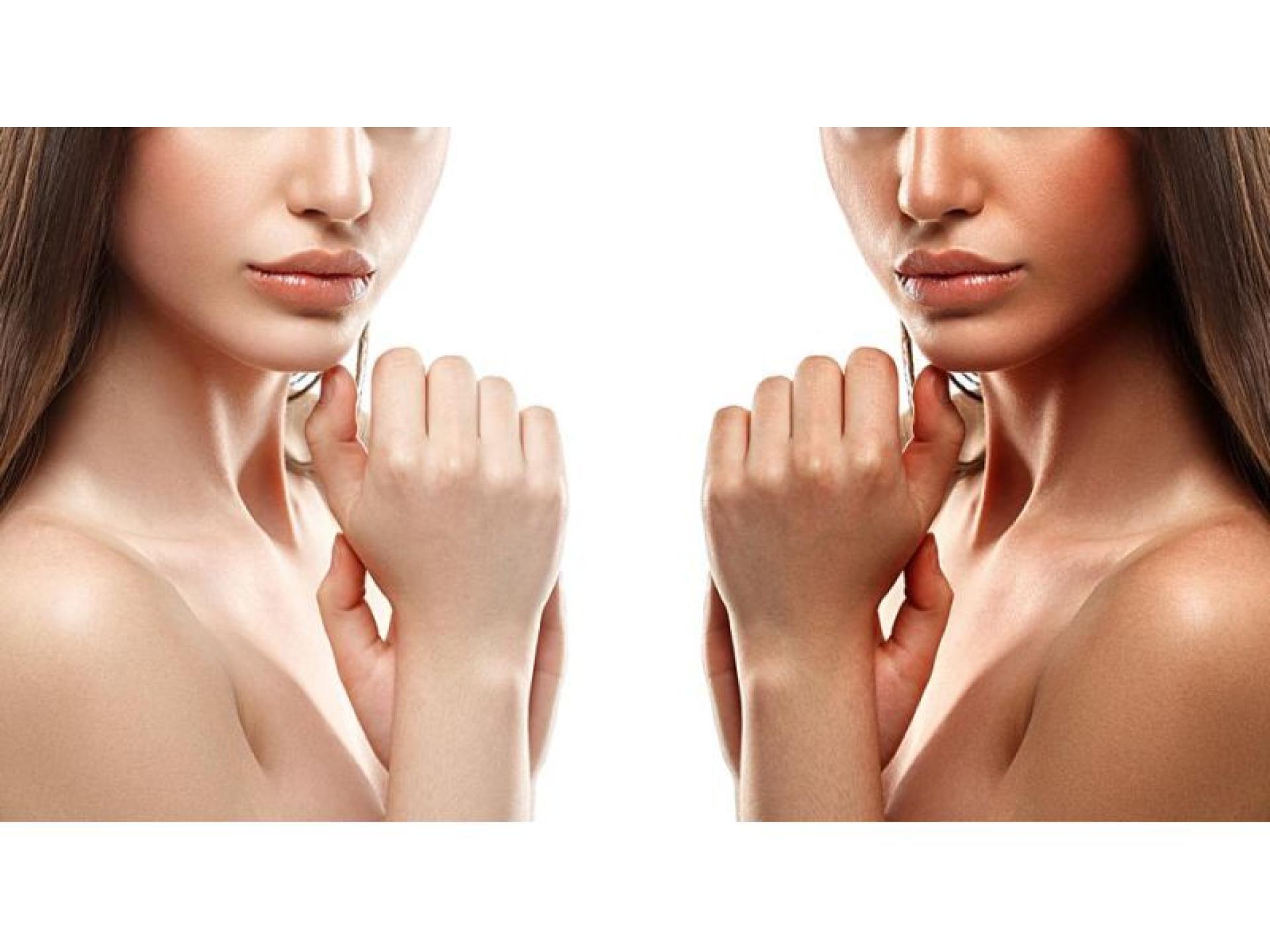 22319 Award Winning Beauty 583243 3