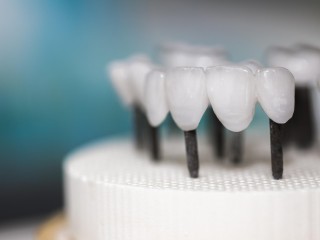 Large Dental Laboratory Adelaide