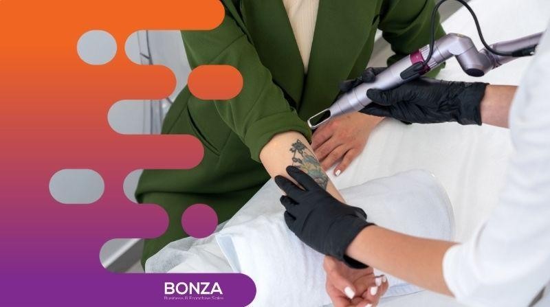 35568 Laser Tattoo Removal 663614 3